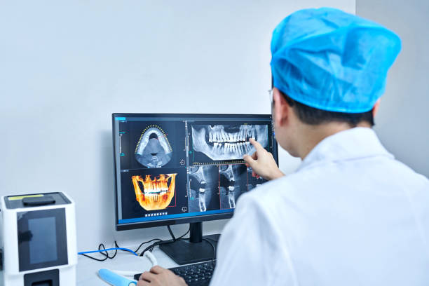 Best Emergency Dentist for Lost Fillings or Crowns in Cresskill, NJ
